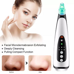 Portable pore cleaner, Black Head Remover, Eshopnix, Skin care