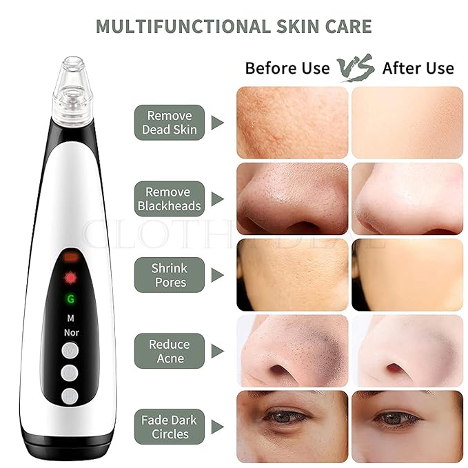 Portable pore cleaner, Black Head Remover, Eshopnix, Skin care